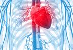 Increased Risk of Myocardial Infarction With Anti-TNF Biologics in RA Increased Risk of Myocardial Infarction With Anti-TNF Biologics in RA