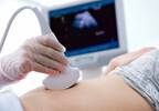 No Significant Increased Risk of Birth Defects in Offspring of Women on Anti-TNF Agents No Significant Increased Risk of Birth Defects in Offspring of Women on Anti-TNF Agents