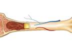 Updated Recommendations for Development of Peak Bone Mass Updated Recommendations for Development of Peak Bone Mass