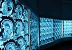Physicians Ordering Imaging Studies Lack Knowledge of Radiation Risks Physicians Ordering Imaging Studies Lack Knowledge of Radiation Risks