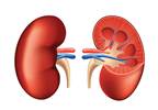 Analysis of Incidence Rates of ESRD in Newly Diagnosed SLE Analysis of Incidence Rates of ESRD in Newly Diagnosed SLE