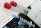 Biomarkers Prognostic of Immunosuppression Side Effects in Vasculitis Biomarkers Prognostic of Immunosuppression Side Effects in Vasculitis