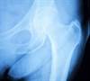 Imaging Recommendations by EULAR for Symptomatic Osteoarthritis Imaging Recommendations by EULAR for Symptomatic Osteoarthritis