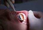 Bi-Directional Links Between Rheumatoid Arthritis and Periodontal Disease Bi-Directional Links Between Rheumatoid Arthritis and Periodontal Disease