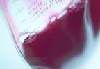 Is Red Blood Cell Storage Length Linked to Mortality? Is Red Blood Cell Storage Length Linked to Mortality?