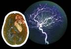 Adults With Lupus More Likely to Have Depression and Anxiety Adults With Lupus More Likely to Have Depression and Anxiety