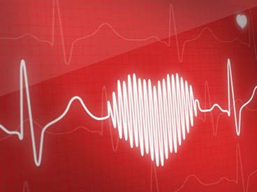 Improved Diagnosis of CVD in Patients With RA: Expert Insights Improved Diagnosis of CVD in Patients With RA: Expert Insights