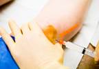 Intramuscular Corticosteroid Injection Reduces Hip Pain in OA Intramuscular Corticosteroid Injection Reduces Hip Pain in OA