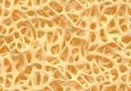 Bone Modulation Strategies for the Prevention of Osteoporosis-Associated Fractures Bone Modulation Strategies for the Prevention of Osteoporosis-Associated Fractures