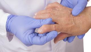 Tight control of inflammation in RA may provide additional benefits for preventing the development of CKD. Tight control of inflammation in RA may provide additional benefits for preventing the development of CKD.