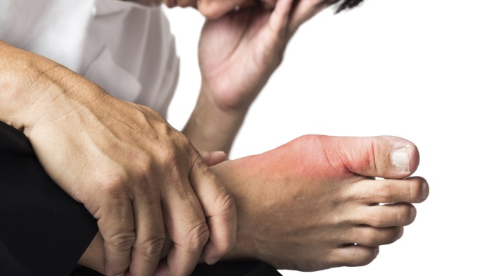 How much allopurinol should i take for gout treatment