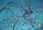 How Sensitive Are Clinical Criteria in Screening for Inflammatory Neuropathies? How Sensitive Are Clinical Criteria in Screening for Inflammatory Neuropathies?