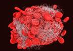 Increased Risk of Venous Thromboembolism in Systemic Sclerosis Increased Risk of Venous Thromboembolism in Systemic Sclerosis