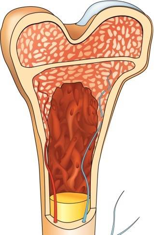 Older men on TRT versus placebo for 1 year had improved hemoglobin levels and volumetric bone mineral density and estimated bone strength. Older men on TRT versus placebo for 1 year had improved hemoglobin levels and volumetric bone mineral density and estimated bone strength.