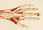 Case Study and Clinical Highlight: Management of Pregnancy in Ehlers-Danlos Syndrome Case Study and Clinical Highlight: Management of Pregnancy in Ehlers-Danlos Syndrome