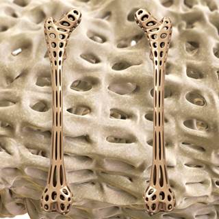 Improvement in BMD was seen with denosumab, which also reduced the incidence of new radiographic vertebral fractures in one high-quality trial. Improvement in BMD was seen with denosumab, which also reduced the incidence of new radiographic vertebral fractures in one high-quality trial.
