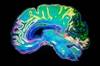 Effects of Sleep Pathophysiology on Rheumatoid Arthritis Effects of Sleep Pathophysiology on Rheumatoid Arthritis