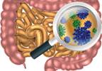 Mechanisms Behind Co-existence of Celiac Disease With SLE Mechanisms Behind Co-existence of Celiac Disease With SLE
