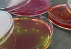 Dose-Response Relationship Between Glucocorticoids and S. aureus Bacteremia Risk Dose-Response Relationship Between Glucocorticoids and S. aureus Bacteremia Risk