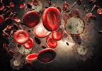Lower Peak Bone Mass, Osteogenic Precursors With HIV T-Cell Activation Lower Peak Bone Mass, Osteogenic Precursors With HIV T-Cell Activation