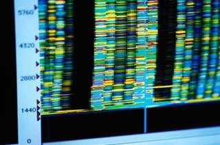 The common genetic pathways between RA and SLE that have been implicated in this study may pave the way for reclassifying patients by genetics for tailored therapy The common genetic pathways between RA and SLE that have been implicated in this study may pave the way for reclassifying patients by genetics for tailored therapy