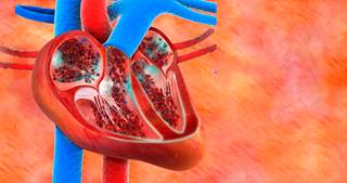 Rivaroxaban did not improve CV outcomes in HF most likely because thrombin-mediated events are not the main cause of HF-related events in patients recently hospitalized for HF. Rivaroxaban did not improve CV outcomes in HF most likely because thrombin-mediated events are not the main cause of HF-related events in patients recently hospitalized for HF.