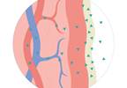 Buprenorphine Implant Noninferior to Sublingual Delivery for Opioid Dependence Buprenorphine Implant Noninferior to Sublingual Delivery for Opioid Dependence