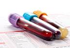 Biomarker Profiles Improve RA Relapse Predictions During DMARD Taper Biomarker Profiles Improve RA Relapse Predictions During DMARD Taper