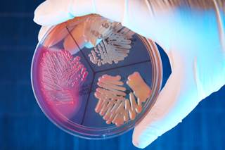 Blood eosinophilia may predict the efficacy of combination therapy to prevent exacerbations in COPD. Blood eosinophilia may predict the efficacy of combination therapy to prevent exacerbations in COPD.