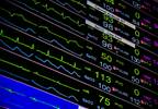 Oxygen Desaturation Index Predicts AFib Risk in Ischemic Stroke Oxygen Desaturation Index Predicts AFib Risk in Ischemic Stroke
