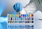 Brain-derived Neurotrophic Factor and its Precursor proBDNF as Diagnostic Biomarkers for Mood Disorders Brain-derived Neurotrophic Factor and its Precursor proBDNF as Diagnostic Biomarkers for Mood Disorders