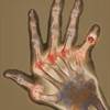 Improving Medication Adherence in Rheumatoid Arthritis Improving Medication Adherence in Rheumatoid Arthritis