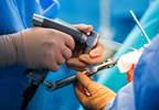 Higher PainDETECT Scores, Neuropathic Pain Preoperatively May Increase Risk for Chronic Pain Post-TKR Higher PainDETECT Scores, Neuropathic Pain Preoperatively May Increase Risk for Chronic Pain Post-TKR
