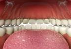 Novel Sublingual Cyclobenzaprine Formulation Improves FM Pain Novel Sublingual Cyclobenzaprine Formulation Improves FM Pain
