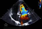 Updated EULAR Guidelines for RA CVD Risk Management Updated EULAR Guidelines for RA CVD Risk Management