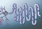Polymyositis May Increase Risk of Amyotrophic Lateral Sclerosis Polymyositis May Increase Risk of Amyotrophic Lateral Sclerosis