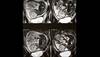 ATA Guidelines for Managing Subclinical Hypothyroidism During Pregnancy: Update ATA Guidelines for Managing Subclinical Hypothyroidism During Pregnancy: Update