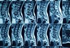 Assessing Efficacy of Open-Label Placebo for Back Pain Assessing Efficacy of Open-Label Placebo for Back Pain