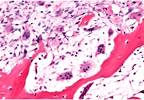 Protectective Effects of DMARDs on Bone Loss Protectective Effects of DMARDs on Bone Loss