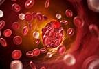 Impact of Glucocorticoids on Endothelial Function in RA Impact of Glucocorticoids on Endothelial Function in RA