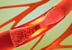 Biologic Therapy in Rheumatoid Arthritis Yields Mixed Results for Comorbid Conditions Biologic Therapy in Rheumatoid Arthritis Yields Mixed Results for Comorbid Conditions