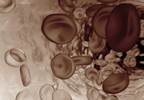 FDA Gives Tocilizumab Priority Review Status for Giant Cell Arteritis FDA Gives Tocilizumab Priority Review Status for Giant Cell Arteritis