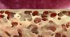 MicroRNAs Linked to Increased Cortical Bone Porosity in Postmenopausal Women With History of Fracture MicroRNAs Linked to Increased Cortical Bone Porosity in Postmenopausal Women With History of Fracture