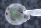 <i>In Vitro</i> Fertilization is Safe and Effective in SLE and APS <i>In Vitro</i> Fertilization is Safe and Effective in SLE and APS