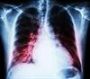 Levothyroxine Associated With Increased Mortality in Heart Failure Levothyroxine Associated With Increased Mortality in Heart Failure