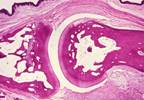 Predicting Lowest Effective Dose For Biologics in Rheumatoid Arthritis Treatment Predicting Lowest Effective Dose For Biologics in Rheumatoid Arthritis Treatment