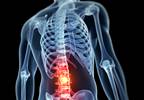 Internet-Based Depression Prevention in Chronic Back Pain Internet-Based Depression Prevention in Chronic Back Pain