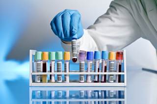 Researchers evaluated several known biomarkers related to the signaling pathways targeted by current treatments for PAH. Researchers evaluated several known biomarkers related to the signaling pathways targeted by current treatments for PAH.