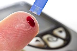 Variability in fasting blood glucose has been shown to be a risk factor for the development of type 2 diabetes.