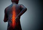 Low Back Pain Treatment Guidelines Released by ACP Low Back Pain Treatment Guidelines Released by ACP